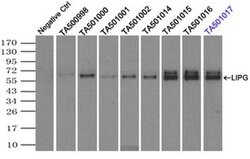 LIPG Monoclonal Antibody (OTI3C7), TrueMAB , OriGene 100 &mu;L; Unconjugated:Antibodies,