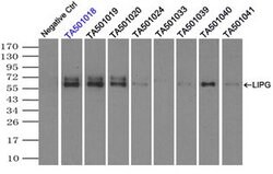 LIPG Monoclonal Antibody (OTI6E11), TrueMAB , OriGene 100 &mu;L; Unconjugated:Antibodies,