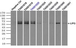 LIPG Mouse anti-Human, Clone: OTI4C3, lyophilized, TrueMAB 100 &mu;g; Unconjugated:Antibodies,