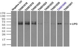 LIPG Monoclonal Antibody (OTI7C2), TrueMAB , OriGene 30 &mu;L; Unconjugated:Antibodies,