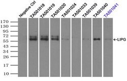 LIPG Mouse anti-Human, Clone: OTI8F8, lyophilized, TrueMAB 100 &mu;g; Unconjugated:Antibodies,