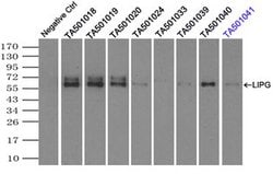 LIPG Monoclonal Antibody (OTI8F8), TrueMAB , OriGene 100 &mu;L; Unconjugated:Antibodies,