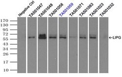 LIPG Monoclonal Antibody (OTI3C4), TrueMAB , OriGene 100 &mu;L; Unconjugated:Antibodies,