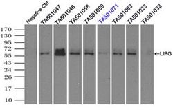LIPG Monoclonal Antibody (OTI6B11), TrueMAB , OriGene 100 &mu;L; Unconjugated:Anticuerpos