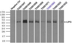 LIPG Mouse anti-Human, Clone: OTI4D2, lyophilized, TrueMAB 100 &mu;g; Unconjugated:Antibodies,