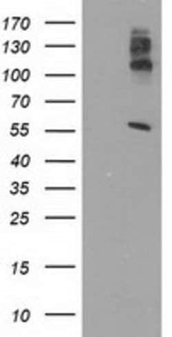 LIPG Monoclonal Antibody (OTI6B9), TrueMAB , OriGene 30 &mu;L; Unconjugated:Antibodies,