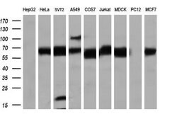 LIPG Monoclonal Antibody (OTI3G7), TrueMAB , OriGene 100 &mu;L; Unconjugated:Antibodies,