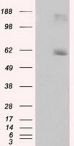 LIPG Monoclonal Antibody (OTI2H10), TrueMAB , OriGene 100 &mu;L; Unconjugated:Antibodies,