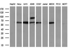 LIPG Monoclonal Antibody (OTI2H10), TrueMAB , OriGene 100 &mu;L; Unconjugated:Antibodies,