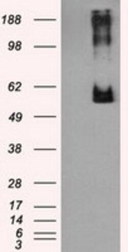 LIPG Mouse anti-Human, Clone: OTI1B8, lyophilized, TrueMAB 100 &mu;g; Unconjugated:Antibodies,