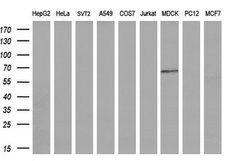 LIPG Mouse anti-Human, Clone: OTI1B8, lyophilized, TrueMAB 100 &mu;g; Unconjugated:Antibodies,
