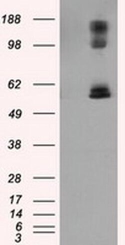 LIPG Monoclonal Antibody (OTI2D5), TrueMAB , OriGene 100 &mu;L; Unconjugated:Antibodies,