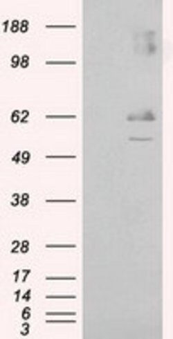 LIPG Mouse anti-Human, Clone: OTI1D9, lyophilized, TrueMAB 100 &mu;g; Unconjugated:Antibodies,