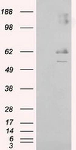 LIPG Monoclonal Antibody (OTI1D9), TrueMAB , OriGene 30 &mu;L; Unconjugated:Anticuerpos