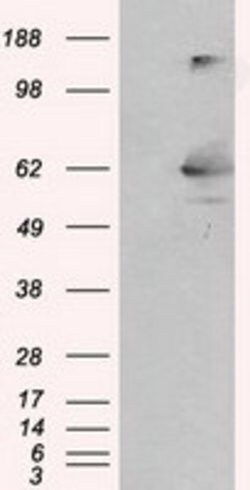 LIPG Monoclonal Antibody (OTI3C7), TrueMAB , OriGene 100 &mu;L; Unconjugated:Antibodies,
