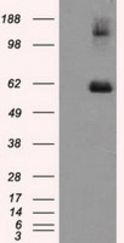 LIPG Monoclonal Antibody (OTI7C2), TrueMAB , OriGene 30 &mu;L; Unconjugated:Antibodies,