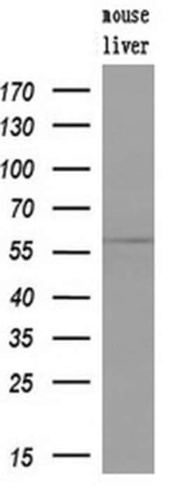 LIPG Monoclonal Antibody (OTI7C2), TrueMAB , OriGene:Antibodies:Primary