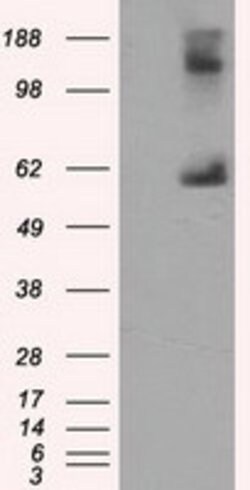 LIPG Mouse anti-Human, Clone: OTI8F8, lyophilized, TrueMAB 100 &mu;g; Unconjugated:Antibodies,