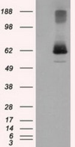 LIPG Mouse anti-Human, Clone: OTI6B11, lyophilized, TrueMAB 100 &mu;g;