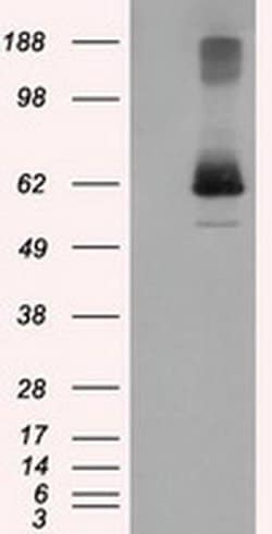 LIPG Monoclonal Antibody (OTI6B11), TrueMAB , OriGene 100 &mu;L; Unconjugated:Anticuerpos