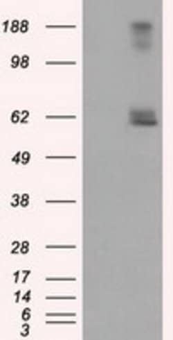 LIPG Mouse anti-Human, Clone: OTI4D2, lyophilized, TrueMAB 100 &mu;g; Unconjugated:Antibodies,