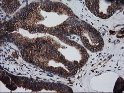 LMAN1 Monoclonal Antibody (OTI1E3), TrueMAB , OriGene 100 &mu;L; Unconjugated:Antibodies,