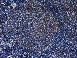 LMAN1 Monoclonal Antibody (OTI1E3), TrueMAB , OriGene 100 &mu;L; Unconjugated:Antibodies,