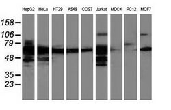 LMAN1 Mouse anti-Human, Clone: OTI2B10, lyophilized, TrueMAB 100 &mu;g | Buy Online | Origene Technologies | Fisher Scientific