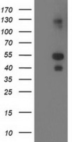 LMCD1 Monoclonal Antibody (OTI2F12), TrueMAB , OriGene 30 &mu;L; Unconjugated:Antibodies,