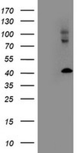 LMCD1 Mouse anti-Human, Clone: OTI1H5, liquid, TrueMAB 100 &mu;L; Unconjugated:Antibodies,