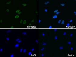 LMNA Monoclonal Antibody (OTI3F6), TrueMAB , OriGene 100 &mu;L; Unconjugated:Antibodies,