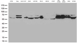 LMNA Mouse anti-Human, Clone: OTI1B7, lyophilized, TrueMAB 100 &mu;g; Unconjugated:Antibodies,