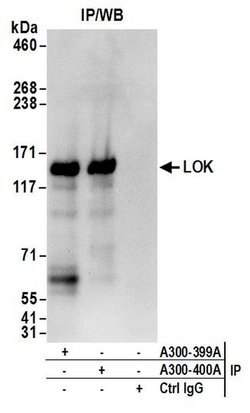 LOK Rabbit anti-Human, Polyclonal, Bethyl Laboratories 100 &mu;L; Unconjugated:Antibodies,