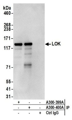 LOK Rabbit anti-Human, Polyclonal, Bethyl Laboratories 100 &mu;L; Unconjugated:Antibodies,
