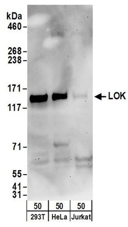 LOK Rabbit anti-Human, Polyclonal, Bethyl Laboratories 100 &mu;L; Unconjugated:Antibodies,