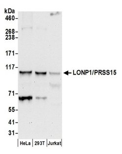 LONP1/PRSS15 Rabbit anti-Human, Polyclonal, Bethyl Laboratories 100 &mu;L;