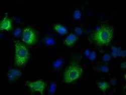 LOX Mouse anti-Human, Clone: OTI9B5, liquid, TrueMAB 100 &mu;L; Unconjugated:Antibodies,