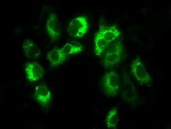 LOX Monoclonal Antibody (OTI7E6), TrueMAB , OriGene 30 &mu;L; Unconjugated:Antibodies,