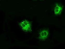 LOX Mouse anti-Human, Clone: OTI6B7, liquid, TrueMAB 100 &mu;L; Unconjugated:Antibodies,