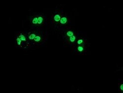 LOX Mouse anti-Human, Clone: OTI10D11, lyophilized, TrueMAB 100 &mu;g;