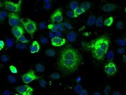LOX Mouse anti-Human, Clone: OTI9A11, liquid, TrueMAB 100 &mu;L; Unconjugated:Antibodies,
