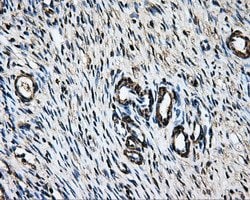 LOX Mouse anti-Human, Clone: OTI6B7, liquid, TrueMAB 100 &mu;L; Unconjugated:Antibodies,