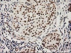 LOX Mouse anti-Human, Clone: OTI10D11, lyophilized, TrueMAB 100 &mu;g;
