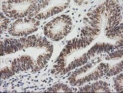 LOX Mouse anti-Human, Clone: OTI10D11, lyophilized, TrueMAB 100 &mu;g;