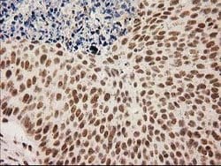 LOX Mouse anti-Human, Clone: OTI10D11, lyophilized, TrueMAB 100 &mu;g;