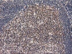 LOX Mouse anti-Human, Clone: OTI10D11, lyophilized, TrueMAB 100 &mu;g;