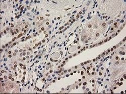 LOX Mouse anti-Human, Clone: OTI10D11, lyophilized, TrueMAB 100 &mu;g;