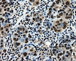 LOX Mouse anti-Human, Clone: OTI9G6, liquid, TrueMAB 100 &mu;L; Unconjugated:Antibodies,