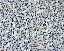 LOX Mouse anti-Human, Clone: OTI9G6, liquid, TrueMAB 100 &mu;L; Unconjugated:Antibodies,