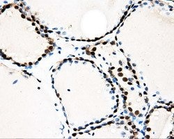 LOX Mouse anti-Human, Clone: OTI9G6, liquid, TrueMAB 100 &mu;L; Unconjugated:Antibodies,